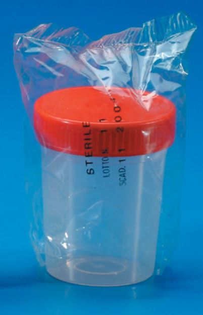 Þvagprufuglas sterílt 100 ml.