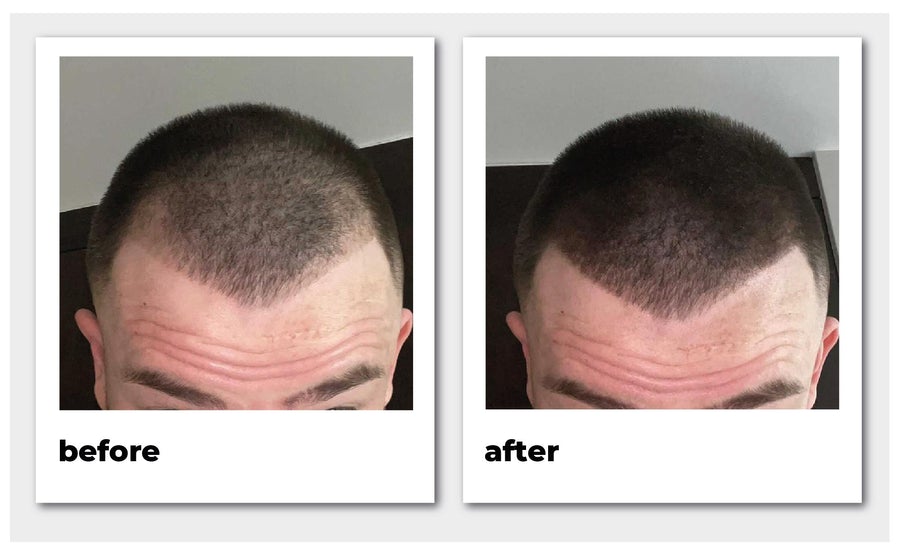 Nanogen Hair Thickening Fibres #Light brown 15 gr. (3)