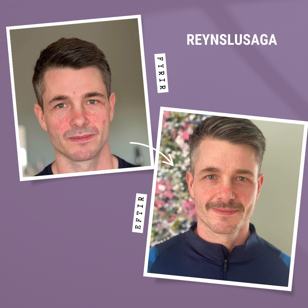 Membrasin Dermal græðikrem fyrir þurra húð 100 ml. (5)