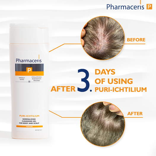 Pharmaceris P-Puri Ichtilium Body and scalp wash gel 225 ml. (1)