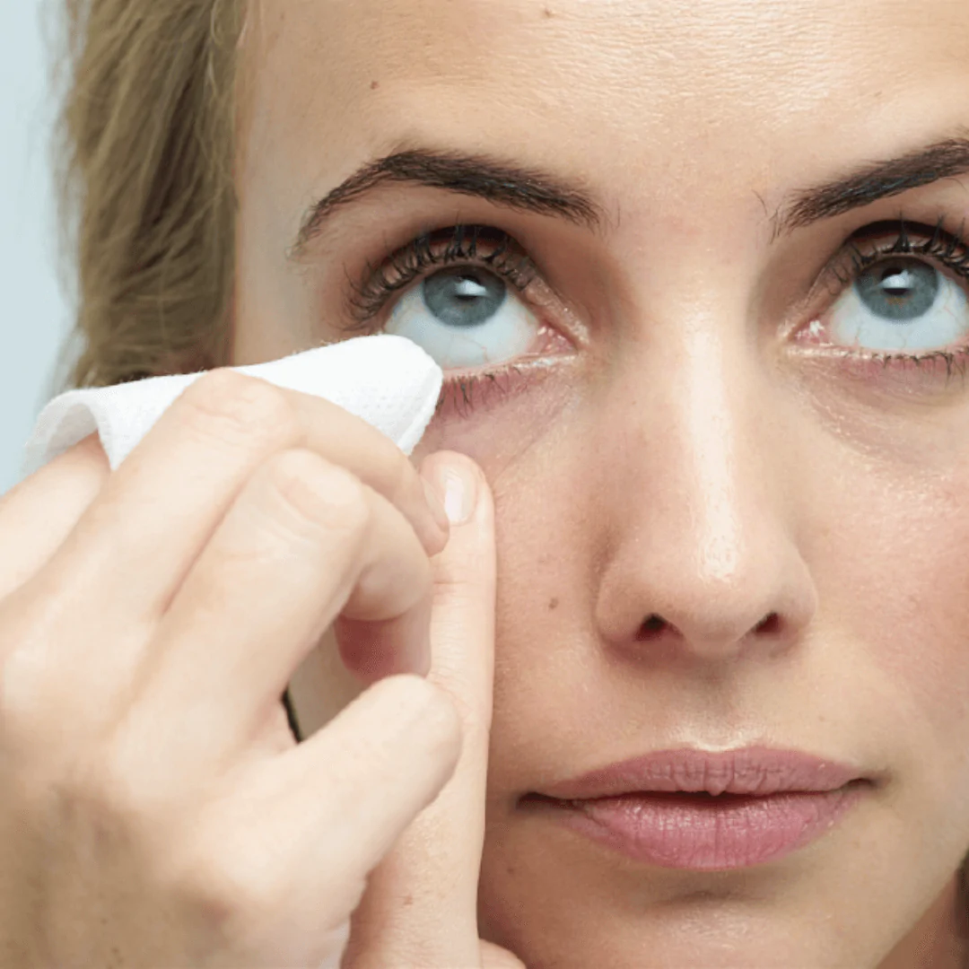 Blephaclean blautpúðar við hvarmabólgu 20 stk. (1)