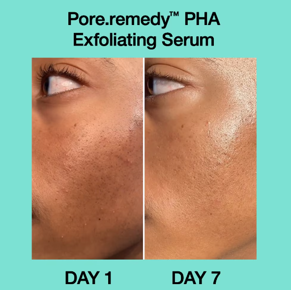 Dr.Jart+ Pore-Remedy PHA Exfoliating Serum 30 ml. (1)