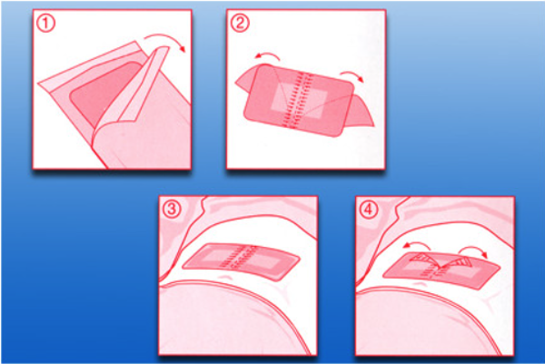 Rudafilm filmuplástur með púða 10 x 8 cm, 1 stk. (3)