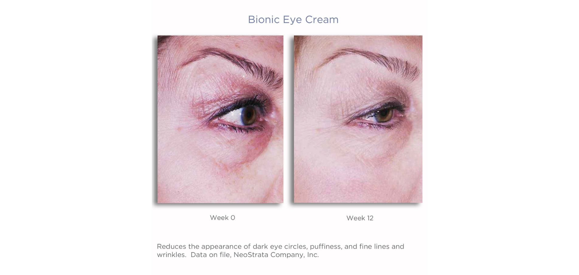 Neostrata Enlighten Brightening Eye Cream 15 gr. (1)