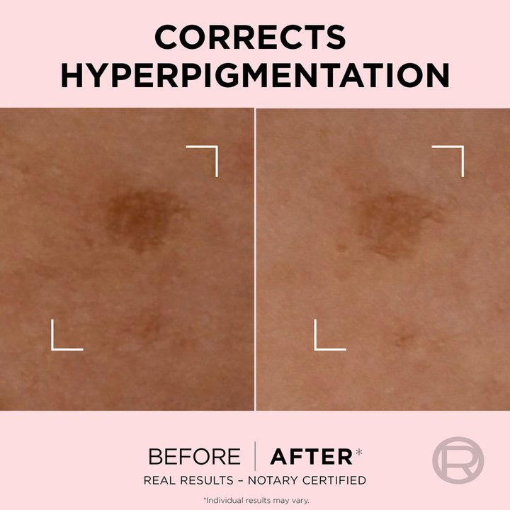 L'Oreal Age Perfect Golden Age Spot Corrector 30 ml. (3)