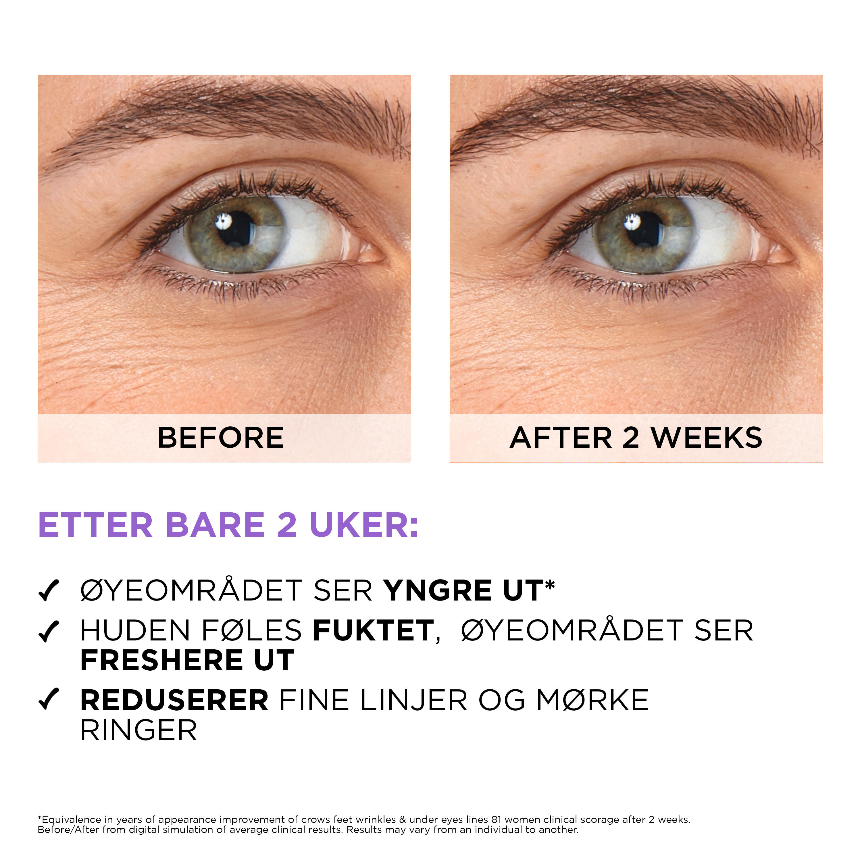 L'Oreal Revitalift Filler Hyaluronc Acid Eye Serum 20 ml. (6)