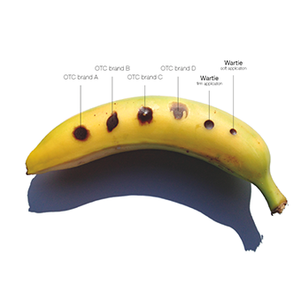 Trimb Wartie Wart & Verruca remover 18 meðferðir (3)