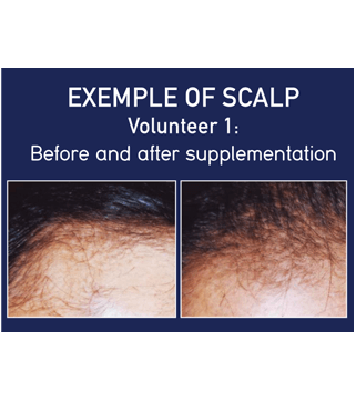 New Nordic Hair Gro 60 stk. (2)