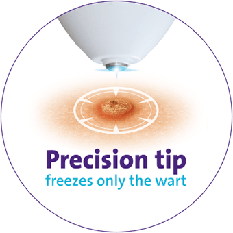 Trimb Wartie Wart & Verruca remover 18 meðferðir (2)