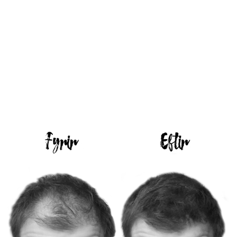 Nanogen Hair Thickening Fibres White 15 gr. (2)