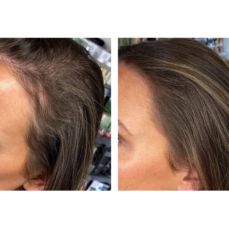 Nanogen Hair Thickening Fibres #Light brown 15 gr. (4)