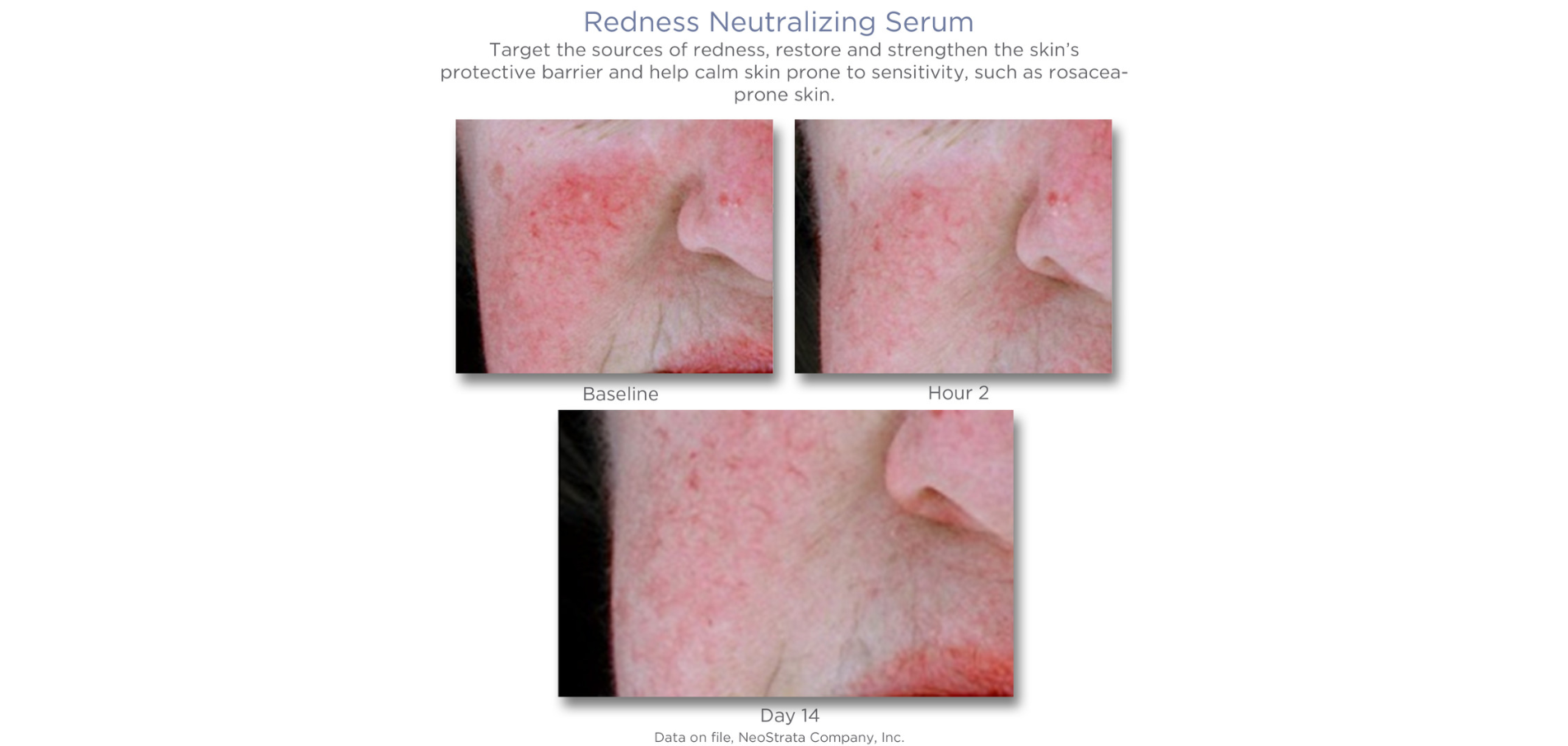 Neostrata Enlighten Brightening Eye Cream 15 gr. (2)