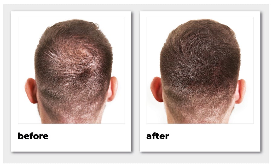 Nanogen Hair Thickening Fibres #Light brown 15 gr. (1)