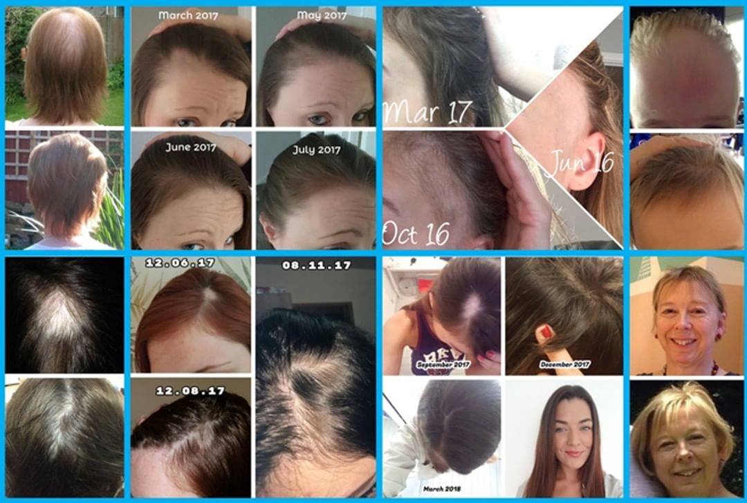 Nourkrin Woman hárkúr 60 töflur (2)