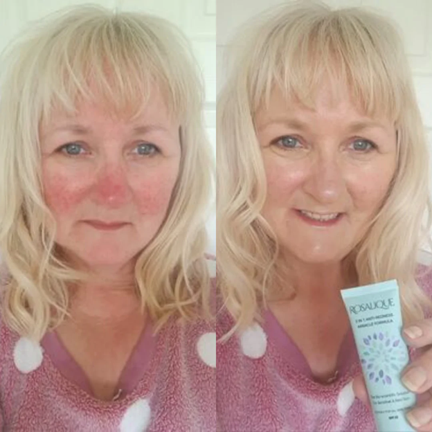 Rosalique anti-redness cream  - gegn rósroða 30 ml. (5)