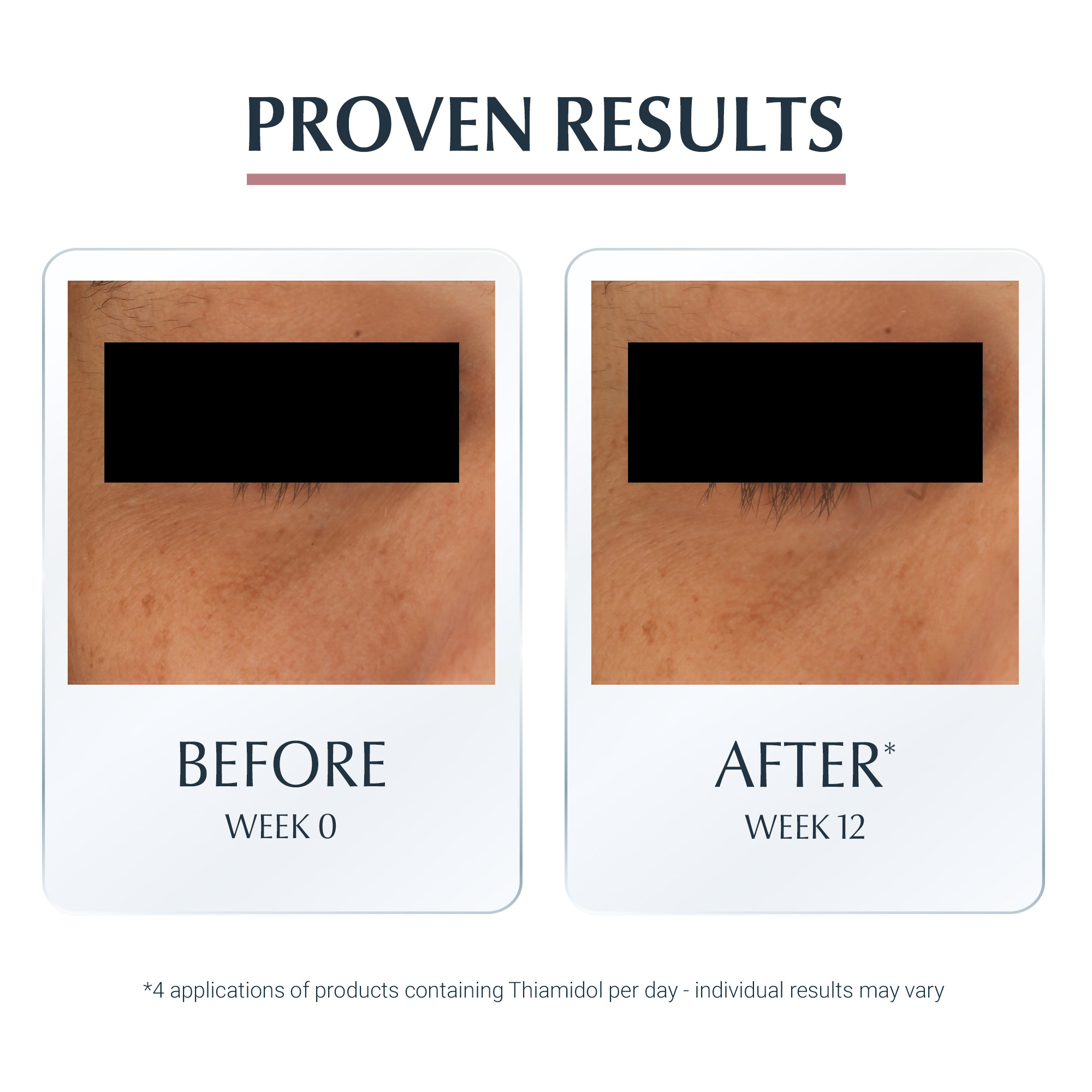 Eucerin Anti-Pigment Dark Circle Illuminating Eye Care 15 ml. (7)