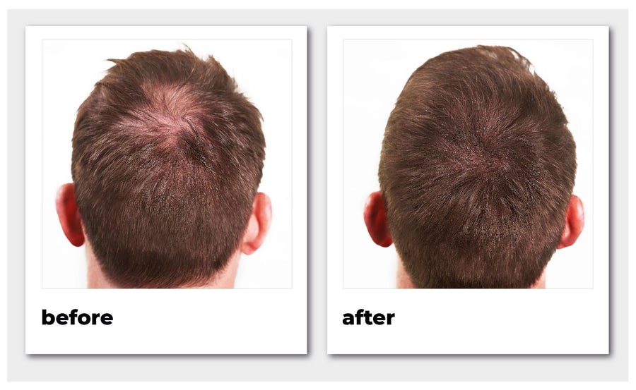 Nanogen Hair Thickening Fibres #Dark Brown 15 gr. (1)