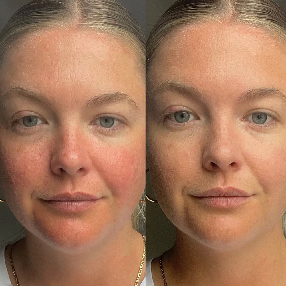 Dr.Jart+ Cicapair Tiger Grass Camo Drops 30 ml. (1)