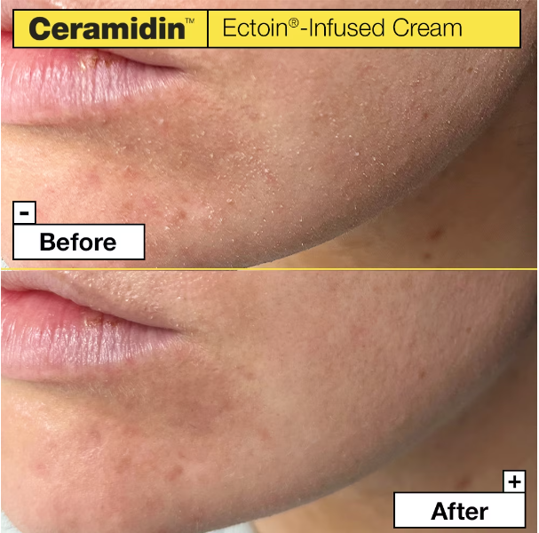 Dr.Jart+ Ceramidin Ectoin-Infused Cream 50 ml. (6)