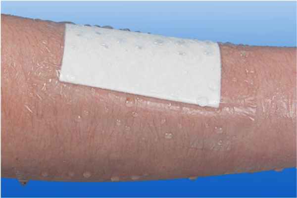 Nobamed Rudafilm filmuplástur steril 7x5cm, 1 stk. (1)