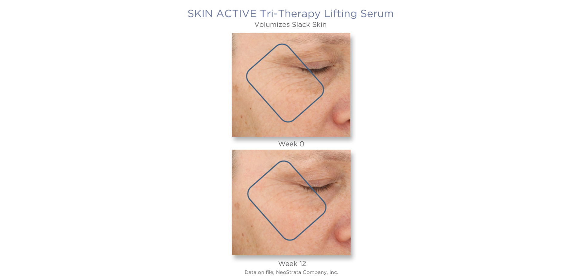 Neostrata Tri-therapy Lifting Serum 30 ml. (2)